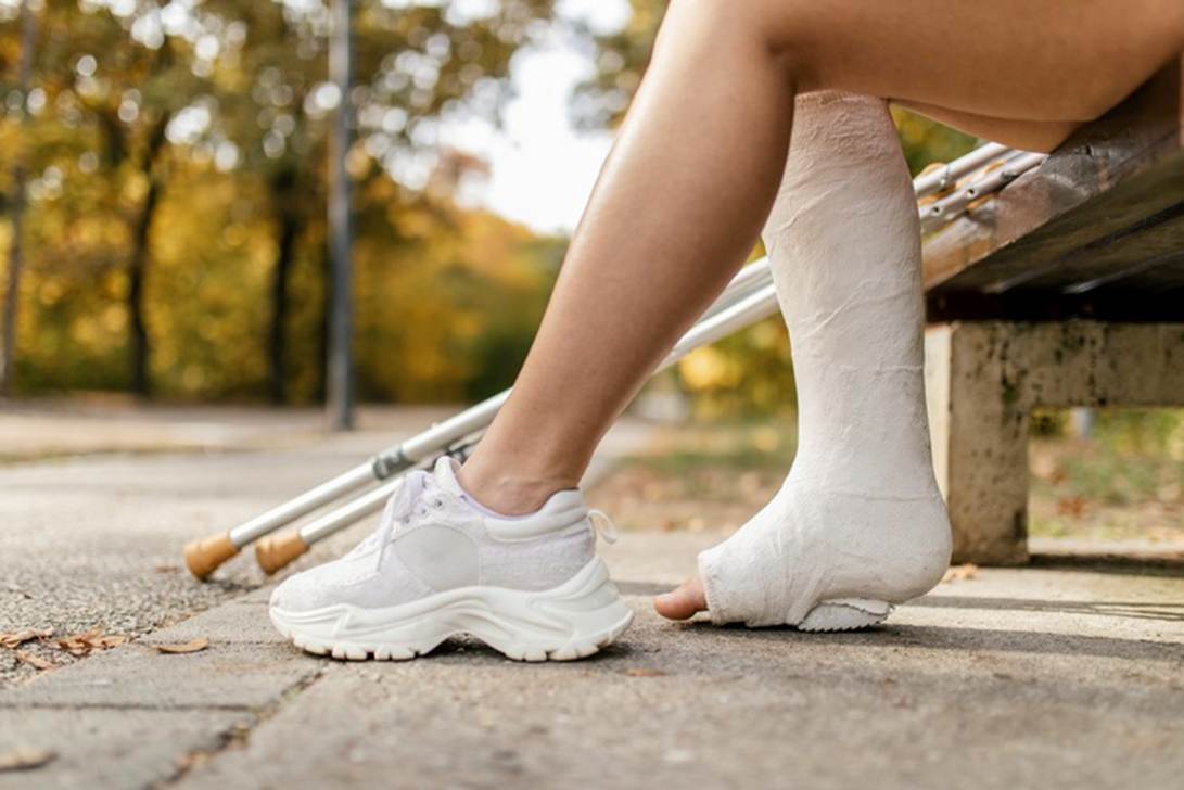 A person with a cast on their leg
AI-generated content may be incorrect.